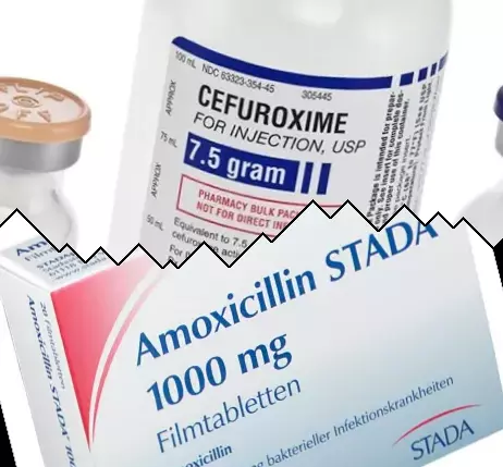 Cefuroksim vs Amoksicillin