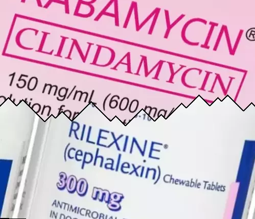 Klindamycin vs Cephalexin