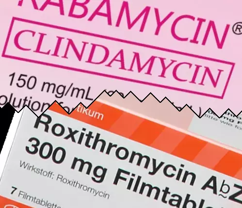 Klindamycin vs Roxitromycin